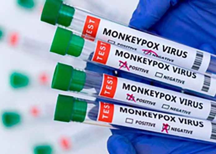 Kerala Man Contracts Monkeypox; Health Officials Confirm MPOX Clade 1b Strain